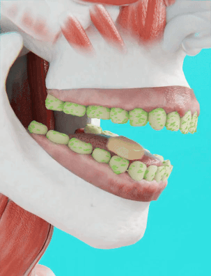 Animation of enamel-supporting minerals on a tooth surface